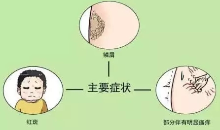 广州肤康皮肤病医院