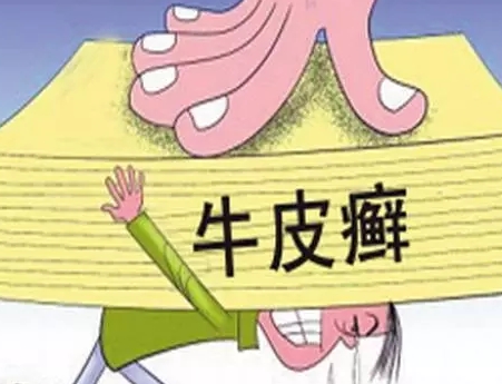 广州肤康皮肤病医院
