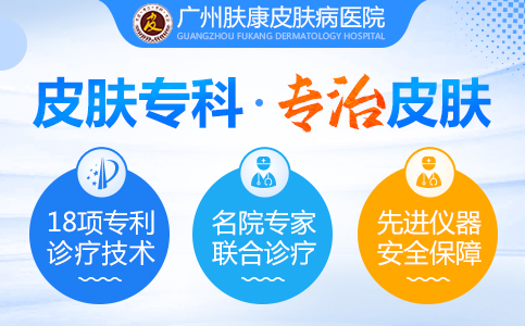 广州肤康皮肤病医院