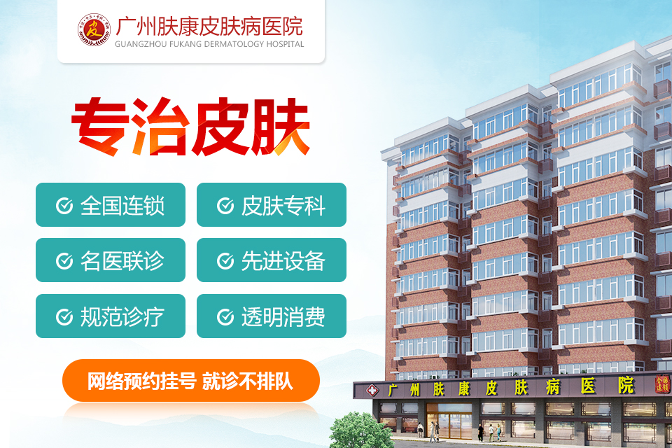 广州肤康皮肤病医院