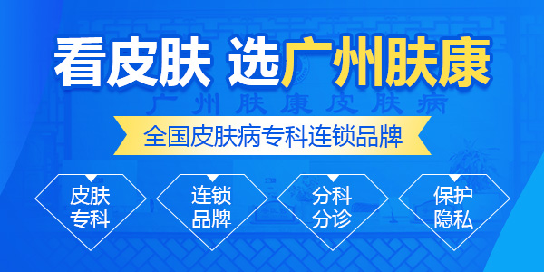 广州肤康皮肤病医院