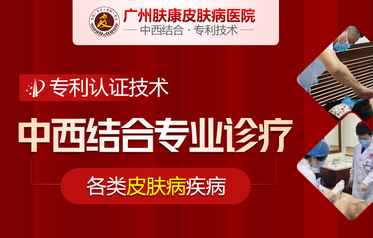 广州肤康皮肤病医院
